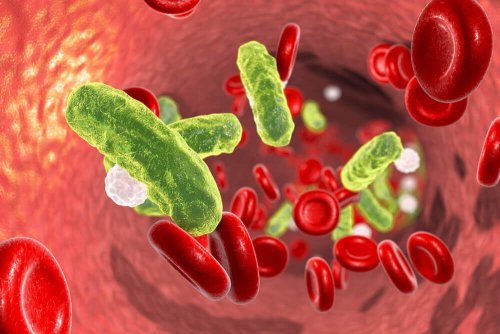 Urinary Sepsis: Causes and Treatments