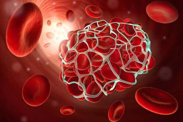 A recreation of a blood clot.