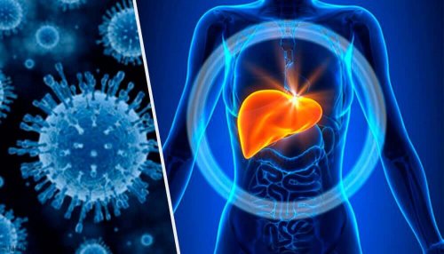 Toxic hepatitis.