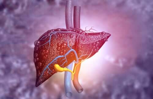 An unhealthy liver.
