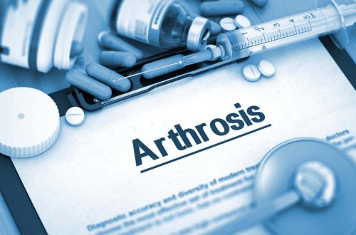 Etoricoxib as a treatment for osteoarthritis.