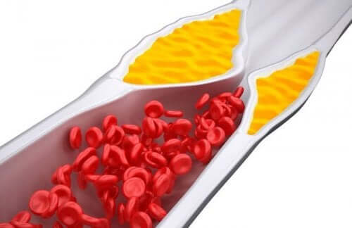 cholesterol