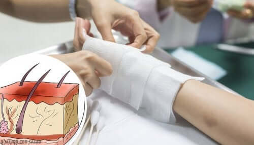 A doctor treating a burn in children.
