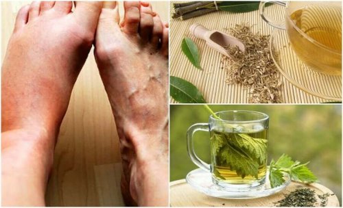 Six Herbal Teas to Lower Uric Acid Levels