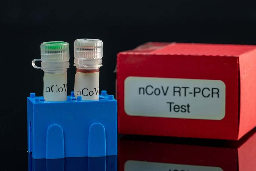 A PCR test.