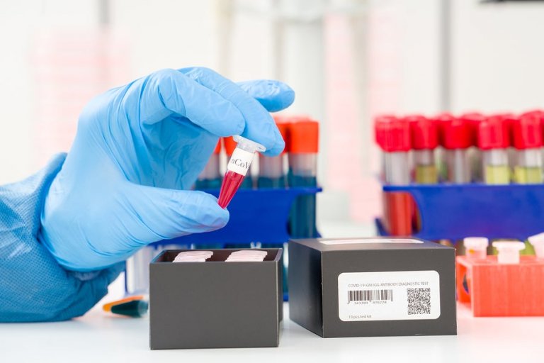 Coronavirus Detection: What's a PCR Test?