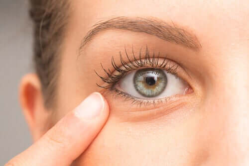 A woman who removed her dark circles.