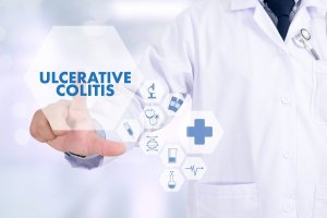 5 Tips to Avoid Episodes of Ulcerative Colitis