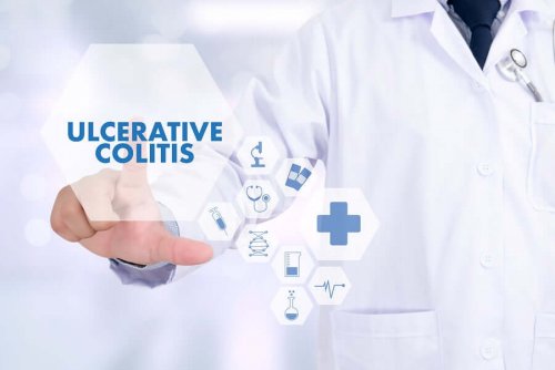 5 Tips to Avoid Episodes of Ulcerative Colitis