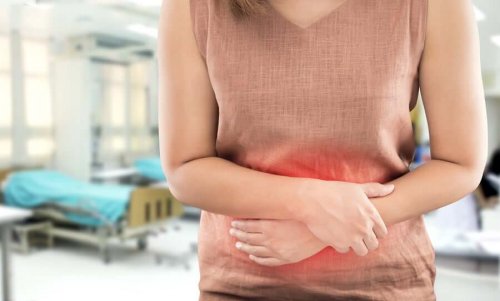 An episode of ulcerative colitis.