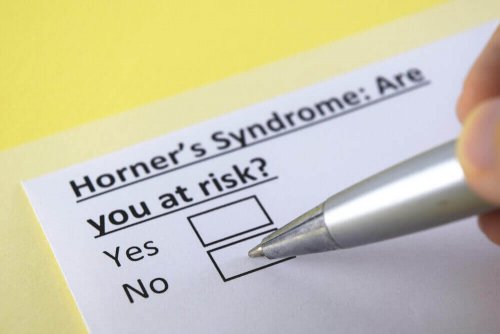 What Is Horner's Syndrome?