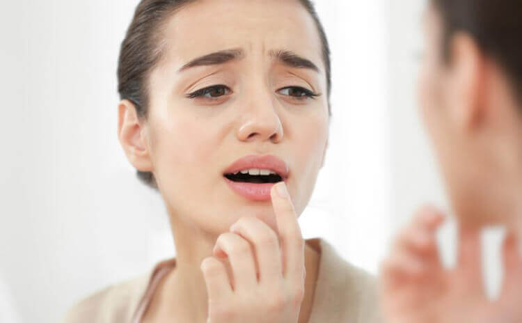A woman with chapped lips.