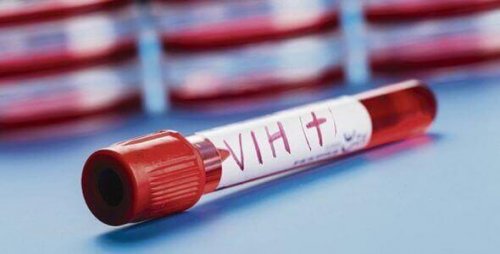 Andra patienten med HIV botad.