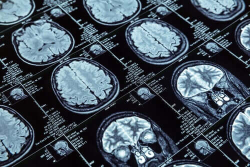 Magnetic resonance images.