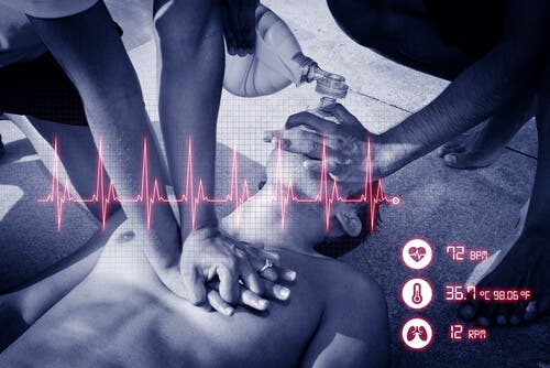 Person with cardiopulmonary arrest getting CPR.