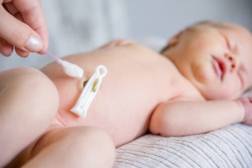 How to Care for a Newborn Baby's Belly Button