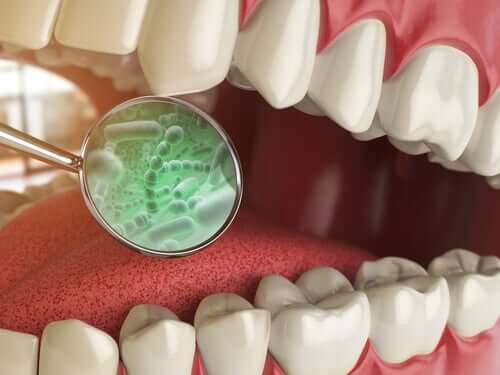 What Are the Kinds of Bacteria in Your Mouth?