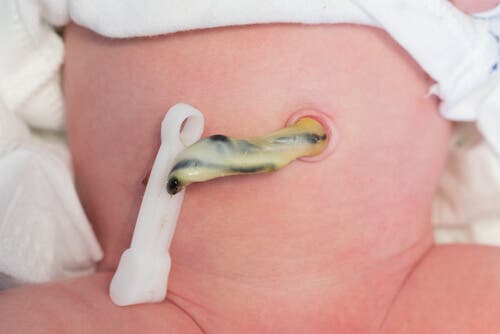 En nyfödds navel.
