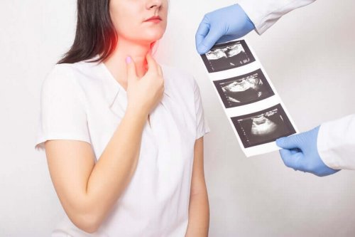 Symptoms and Treatment of Thyroid Cancer
