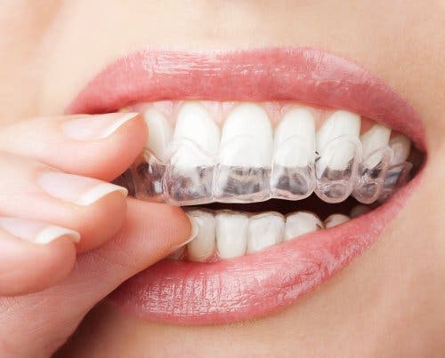 A woman trying a dental treatment.