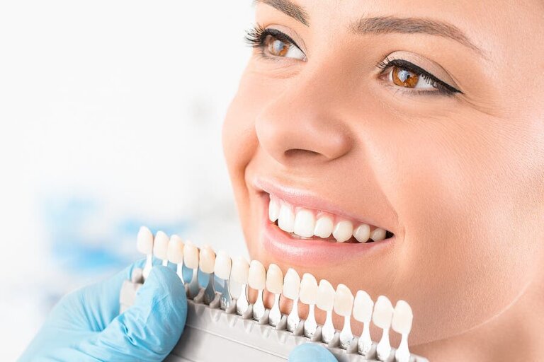 Teeth Whitening Procedures - Description and Types