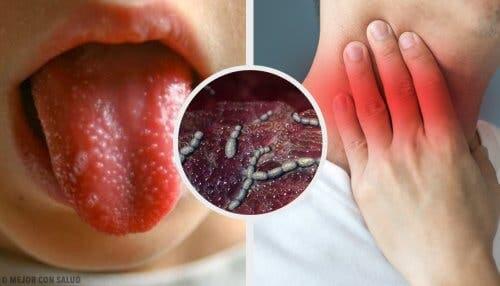 Symptoms of scarlet fever in children.