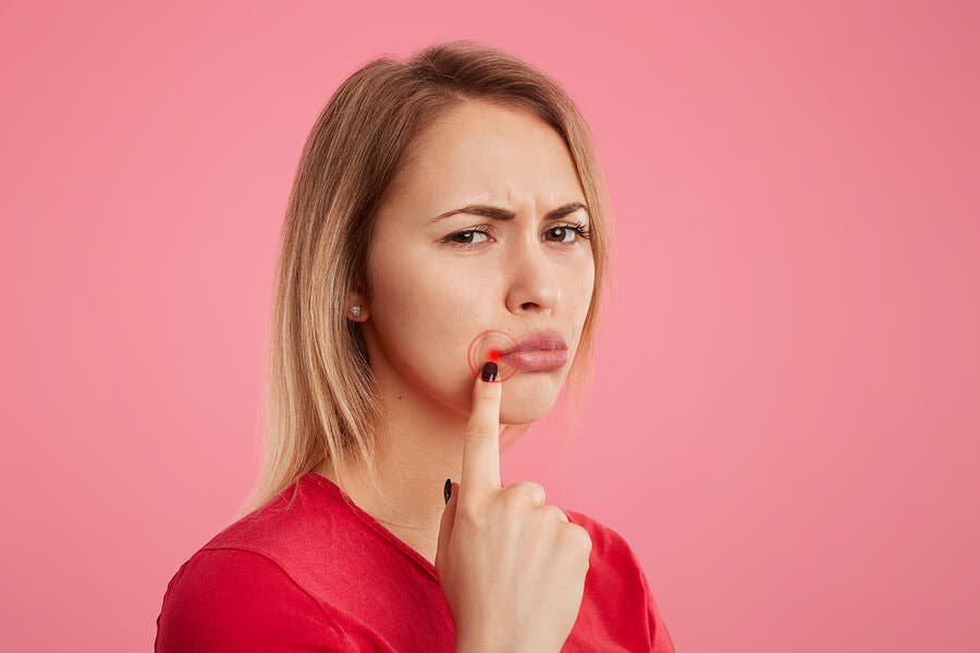 5 Ways to Get Relief from Cold Sores Fast