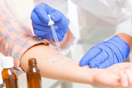 Doctor administering an allergy test on a patient's arm.