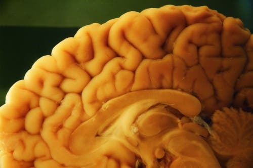 A brain autopsy.
