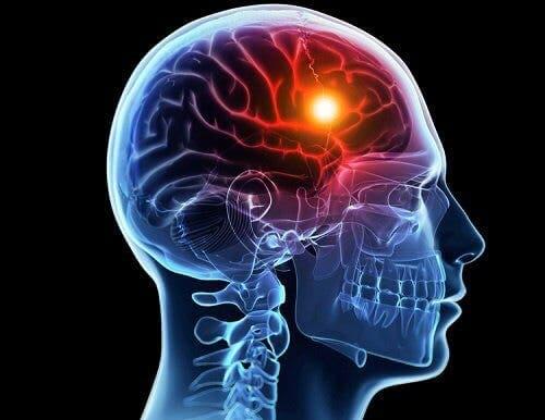 A brain lit up.