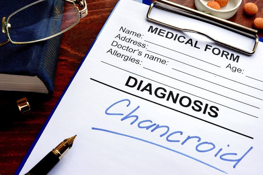 The Symptoms and Treatment of Chancroid