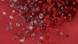 Cerebral Embolism: What Is it and How Does it Affect Us?