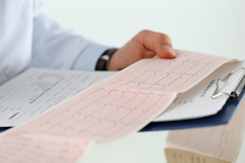 An EKG.