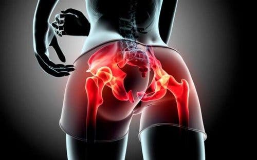Graphic showing x-ray image of a person's buttocks.