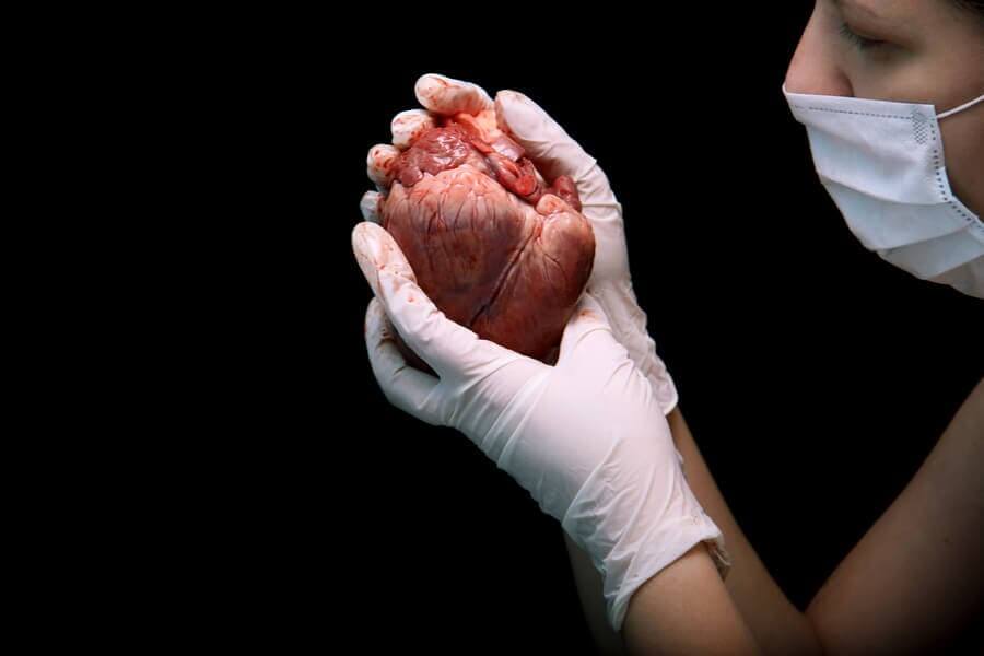What Does a Heart Transplant Consist Of?