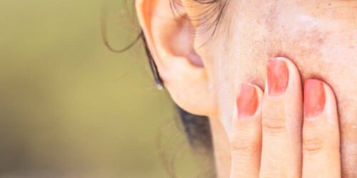 Woman with spots on her face correct dark spots