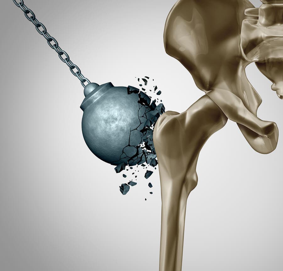 Reducing the Damage of Osteoporosis After Menopause