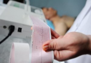 What Tests Detect a Pericardial Effusion