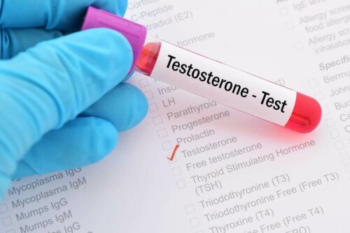 What’s Testosterone Deficiency Syndrome?