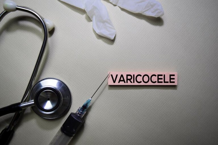 What You Should Know About Varicoceles