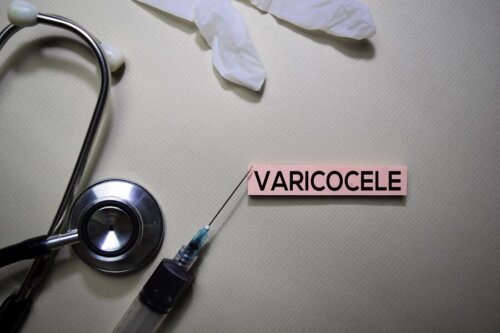 What You Should Know About Varicoceles Step To Health