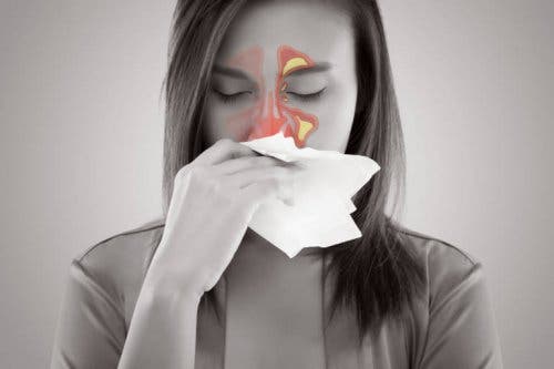 A woman with sinusitis.