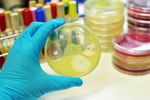 A person holding a petri dish.