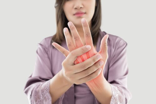 A woman with arthritis.