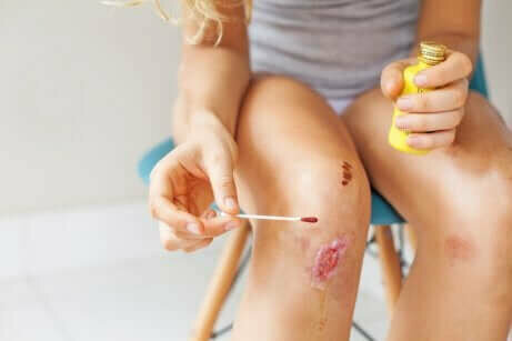 Person cleaning a cut on their knee to treat an infected wound.