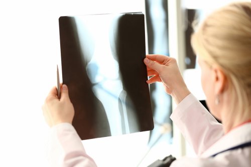 Calcium and Vitamin D-Rich Foods to Care for Your Bone Health
