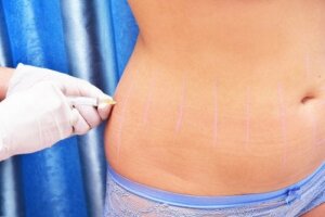 What Is Lipotherapy and What Is It For?