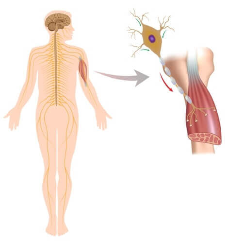 A graphic showing a closeup of the effects on muscles of neuromuscular disorders.
