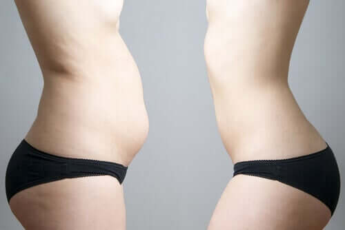 Mirror image of woman with less stomach fat from cryolipolysis.