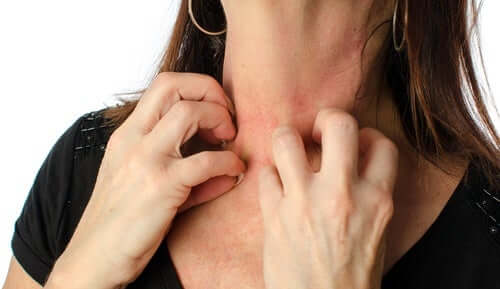 A woman scratching her skin.
